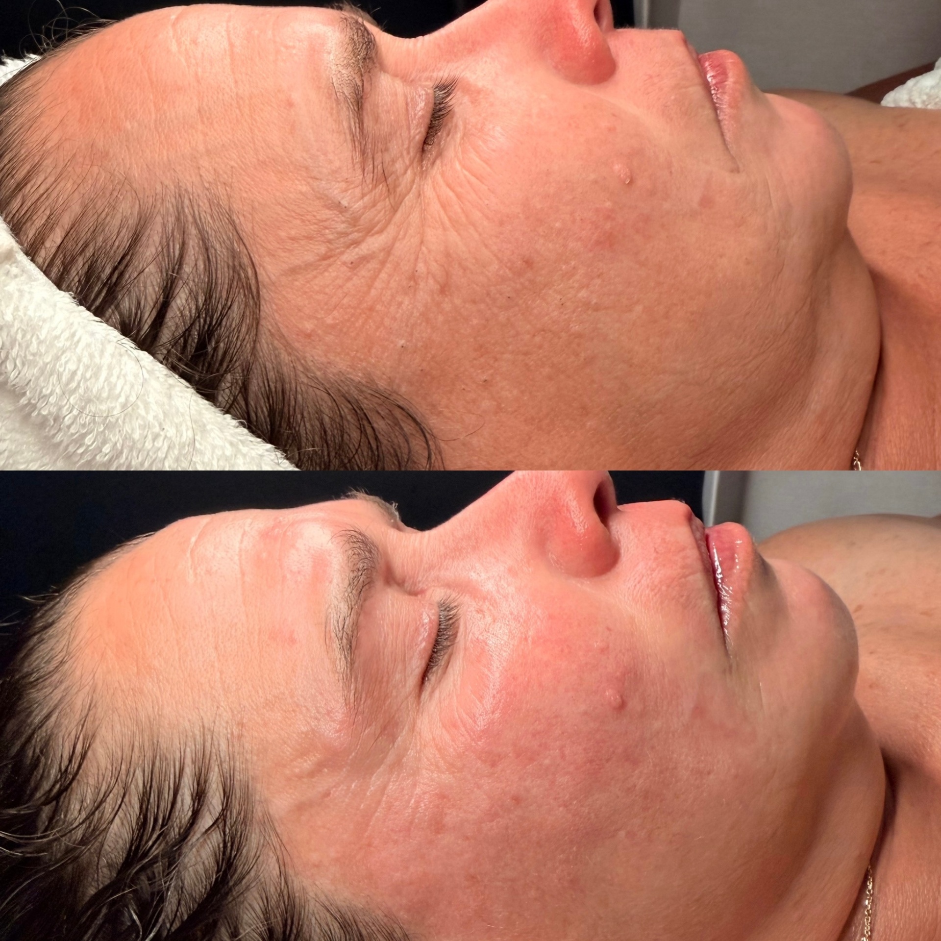 Before and after — The Intuitive Ritual