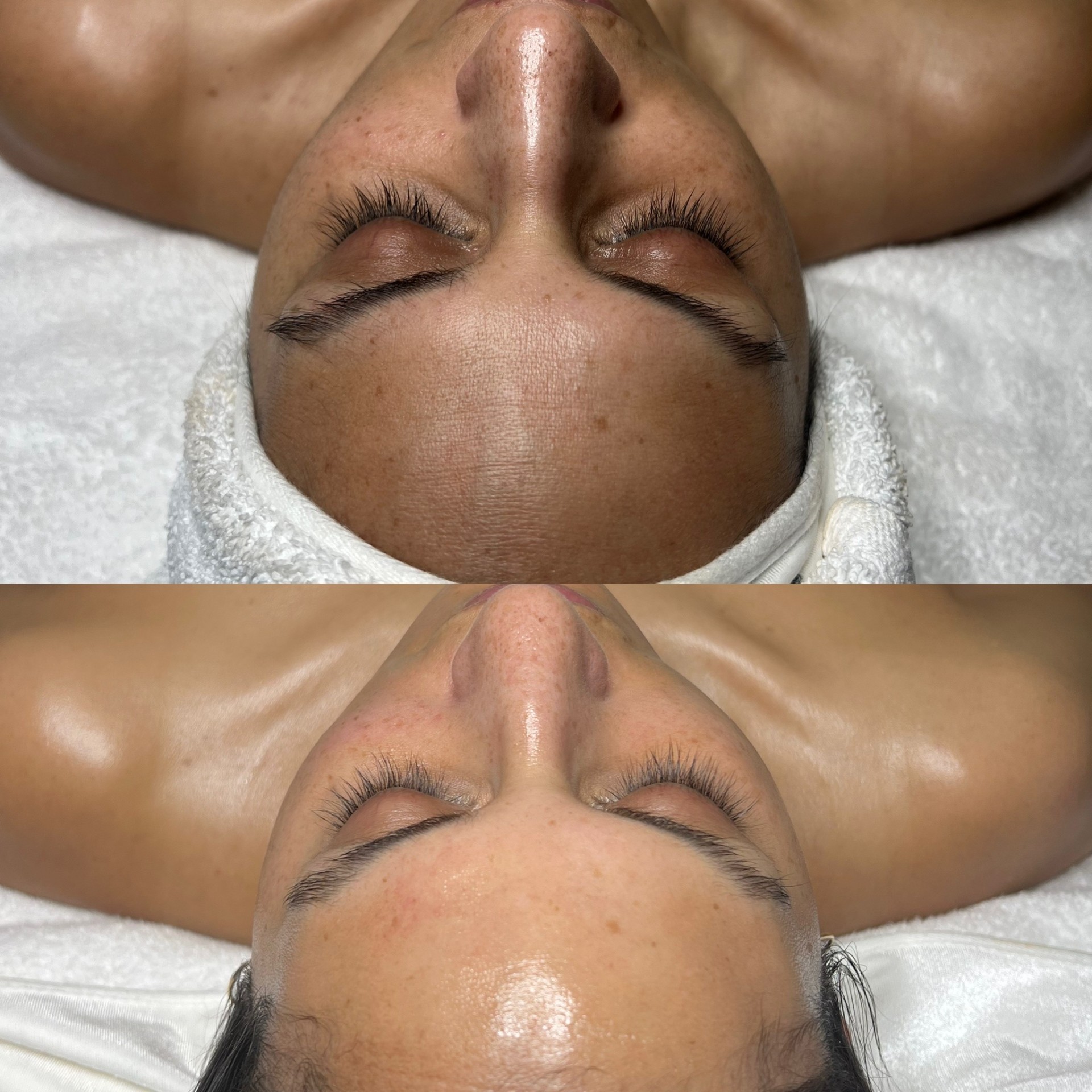 Before and after — The Sacred Glow treatment